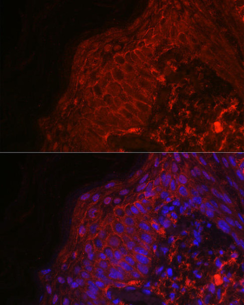 Cell Biology Antibodies 4 Anti-EGF Antibody CAB13615