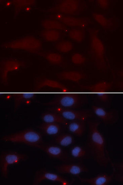 Immunology Antibodies 1 Anti-KPNA1 Antibody CAB13623