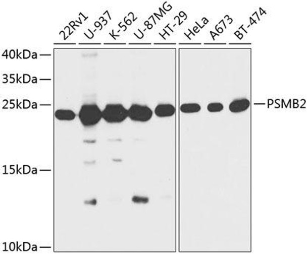 Immunology Antibodies 1 Anti-PSMB2 Antibody CAB13630