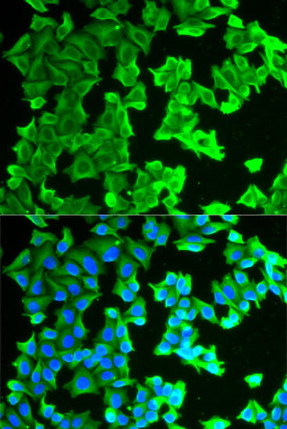 Immunology Antibodies 1 Anti-RPLP0 Antibody CAB13633