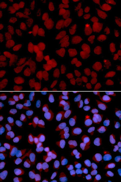Cell Death Antibodies 1 Anti-TNFAIP3 Antibody CAB13637