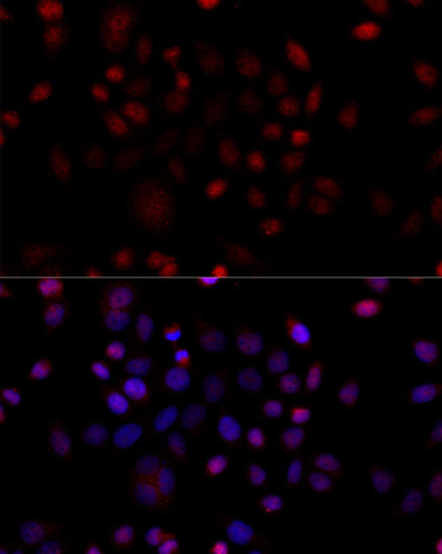 Cell Death Antibodies 1 Anti-VDAC1 / Porin Antibody CAB13638