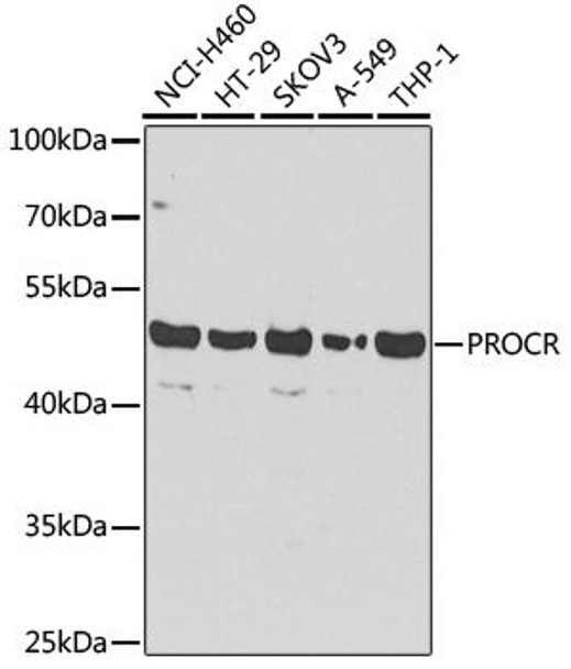 Cardiovascular Antibodies Anti-PROCR Antibody CAB13641