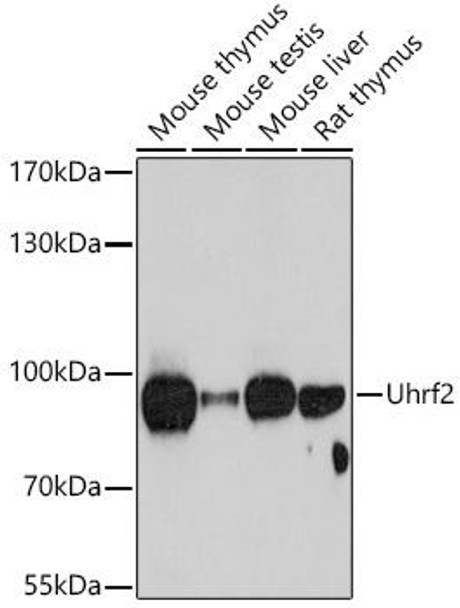 Cell Biology Antibodies 4 Anti-Uhrf2 Antibody CAB13647