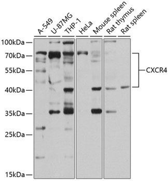 Immunology Antibodies 1 Anti-CXCR4 Antibody CAB13672