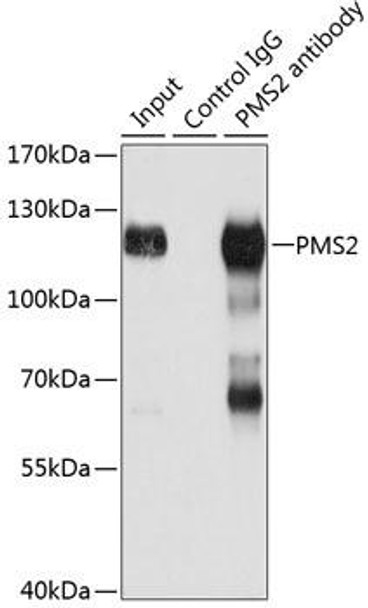 Epigenetics and Nuclear Signaling Antibodies 1 Anti-PMS2 Antibody CAB13680