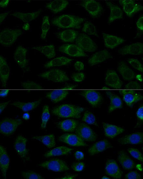 Cell Biology Antibodies 4 Anti-NDUFB7 Antibody CAB13693