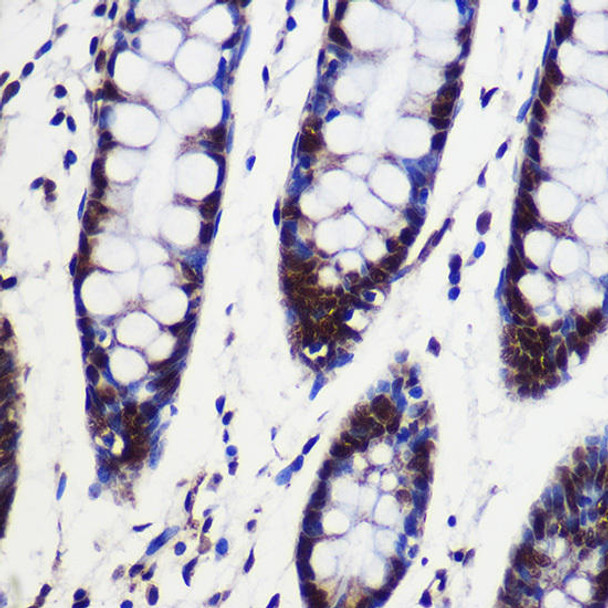 Epigenetics and Nuclear Signaling Antibodies 1 Anti-SARNP Antibody CAB13701