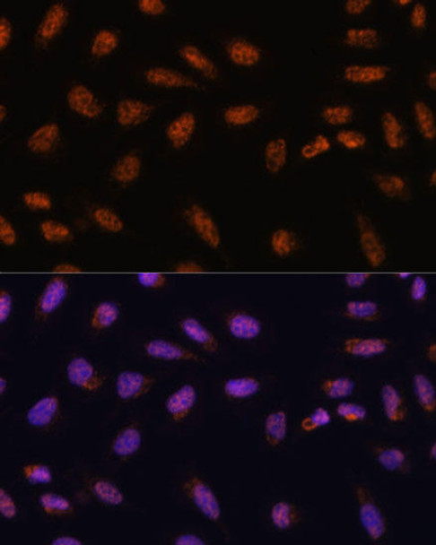 Epigenetics and Nuclear Signaling Antibodies 1 Anti-SARNP Antibody CAB13701