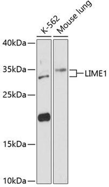 Immunology Antibodies 1 Anti-LIME1 Antibody CAB13719