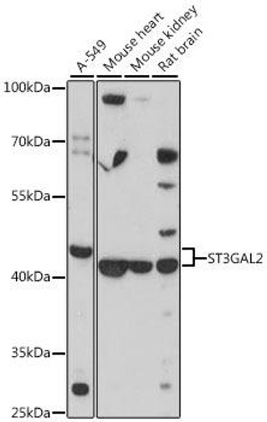Cell Biology Antibodies 4 Anti-ST3GAL2 Antibody CAB13733
