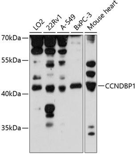 Cell Cycle Antibodies 1 Anti-CCNDBP1 Antibody CAB13735
