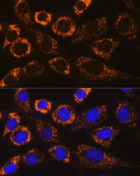 Cell Biology Antibodies 4 Anti-P4HA3 Antibody CAB13767