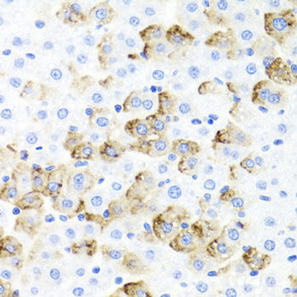 Cardiovascular Antibodies Anti-F3 Antibody CAB1378