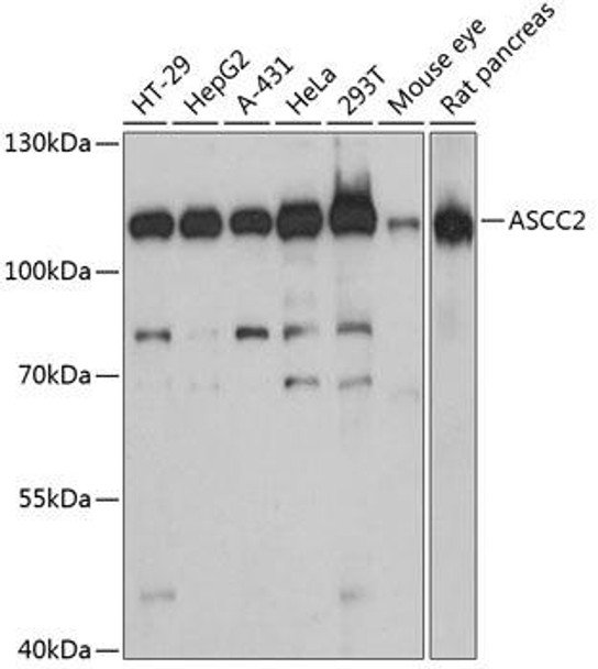 Epigenetics and Nuclear Signaling Antibodies 1 Anti-ASCC2 Antibody CAB13789