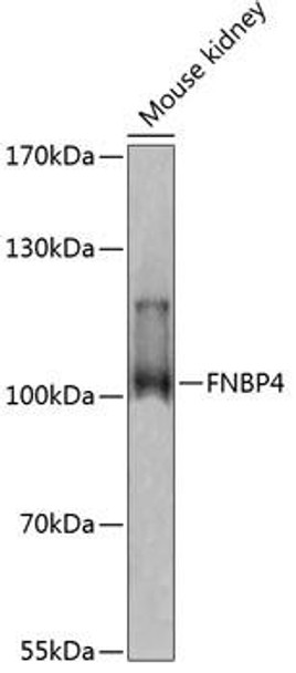 Cell Biology Antibodies 4 Anti-FNBP4 Antibody CAB13804