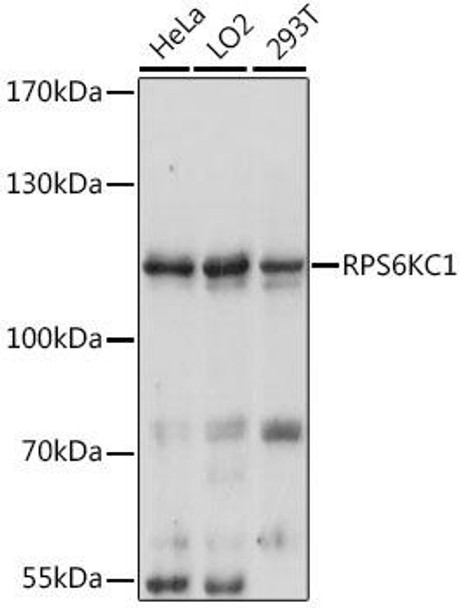 Cell Biology Antibodies 4 Anti-RPS6KC1 Antibody CAB13807
