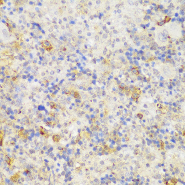 Cell Biology Antibodies 4 Anti-GCC2 Antibody CAB13814