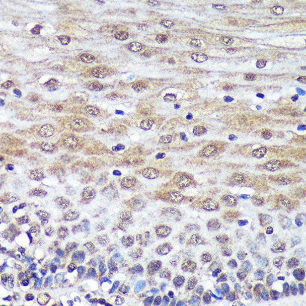 Developmental Biology Anti-PSME4 Antibody CAB13815