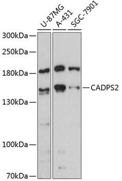 Cell Biology Antibodies 4 Anti-CADPS2 Antibody CAB13821