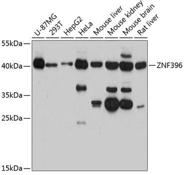 Epigenetics and Nuclear Signaling Antibodies 1 Anti-ZNF396 Antibody CAB13836
