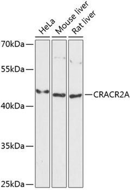 Immunology Antibodies 1 Anti-CRACR2A Antibody CAB13839