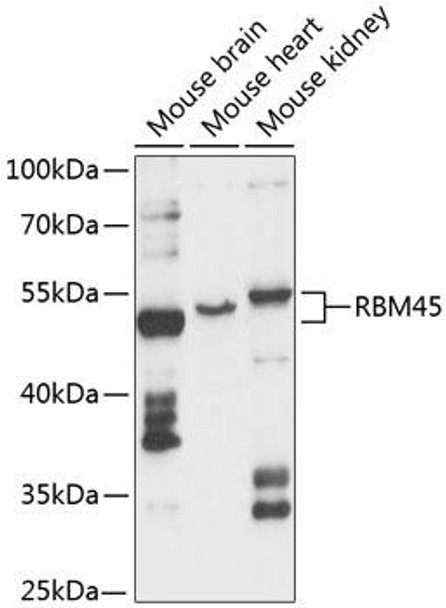 Developmental Biology Anti-RBM45 Antibody CAB13843