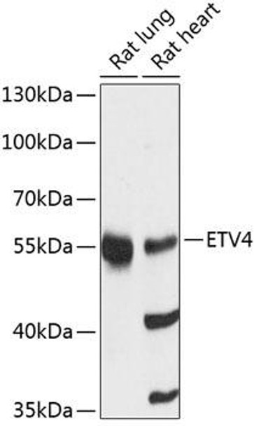 Epigenetics and Nuclear Signaling Antibodies 1 Anti-ETV4 Antibody CAB13860