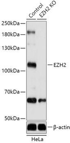 KO Validated Antibodies 1 Anti-EZH2 Antibody CAB13867KO Validated