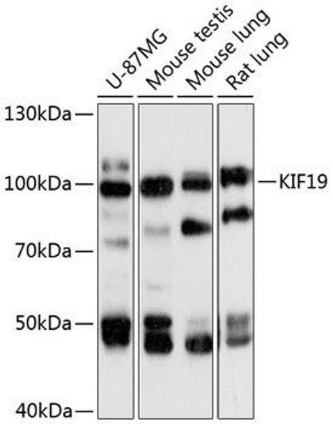 Cell Biology Antibodies 4 Anti-KIF19 Antibody CAB13868