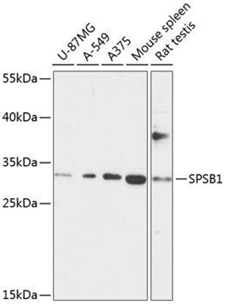 Signal Transduction Antibodies 1 Anti-SPSB1 Antibody CAB13886