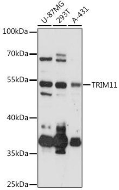 Immunology Antibodies 1 Anti-TRIM11 Antibody CAB13887