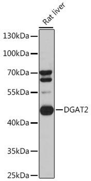 Metabolism Antibodies 1 Anti-DGAT2 Antibody CAB13891