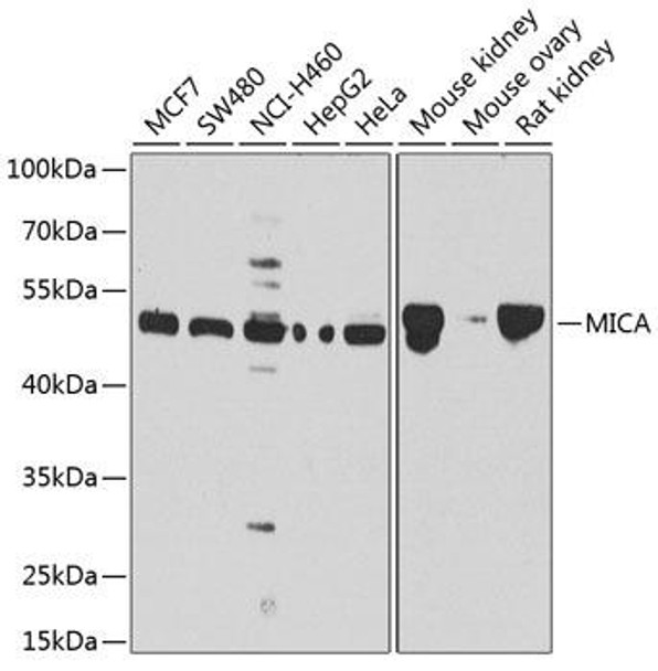 Immunology Antibodies 1 Anti-MICA Antibody CAB1390