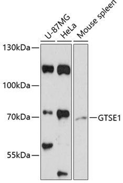 Cell Biology Antibodies 4 Anti-GTSE1 Antibody CAB13903