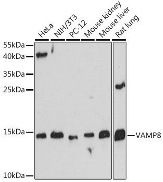 Autophagy Antibodies Anti-VAMP8 Antibody CAB13915
