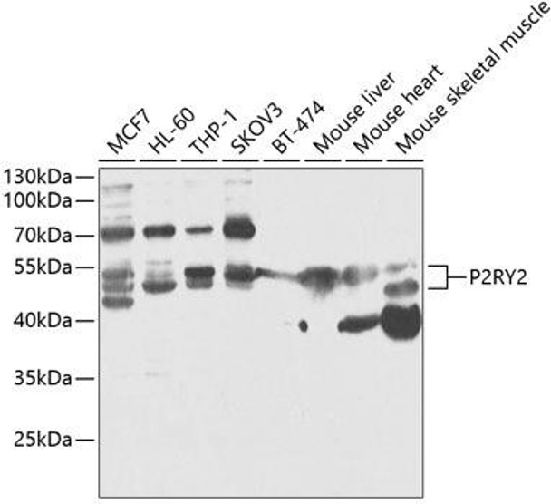 Cell Biology Antibodies 4 Anti-P2RY2 Antibody CAB13923