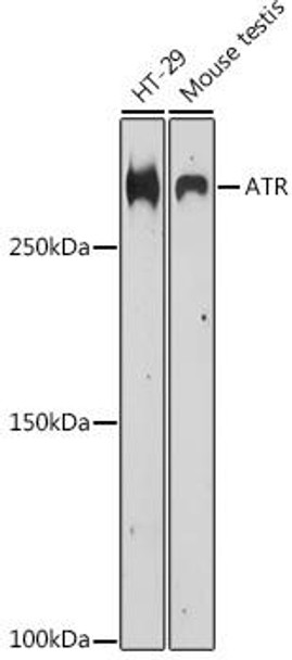 Epigenetics and Nuclear Signaling Antibodies 1 Anti-ATR Antibody CAB13951