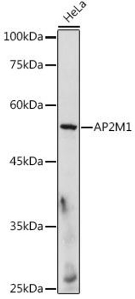 Cell Biology Antibodies 4 Anti-AP2M1 Antibody CAB13962