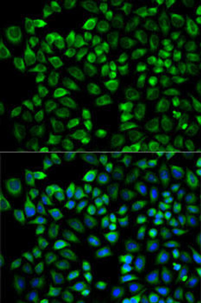 Cell Biology Antibodies 4 Anti-AP2M1 Antibody CAB13962