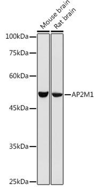 Cell Biology Antibodies 4 Anti-AP2M1 Antibody CAB13962
