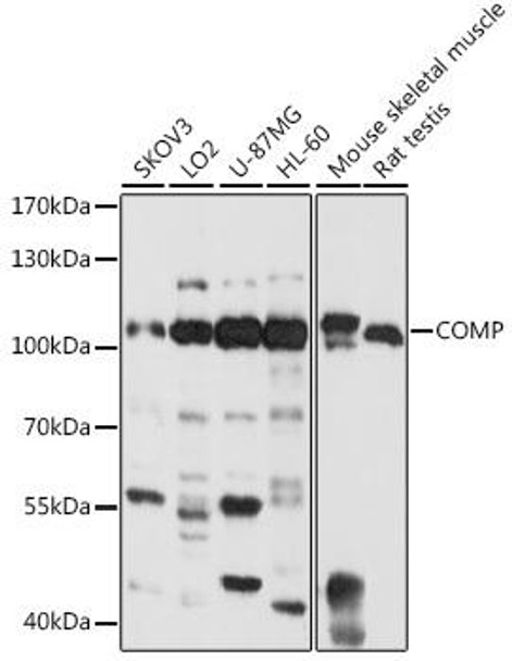 Cell Death Antibodies 1 Anti-COMP Antibody CAB13963