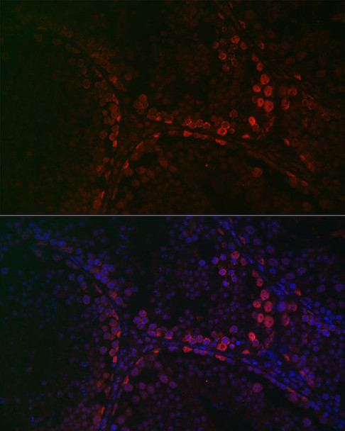 Developmental Biology Anti-DAZL Antibody CAB13970