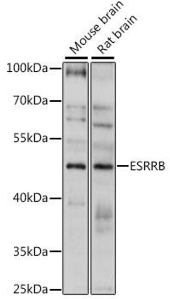 Epigenetics and Nuclear Signaling Antibodies 3 Anti-ESRRB Antibody CAB13977