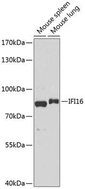 Cell Death Antibodies 1 Anti-IFI16 Antibody CAB14002