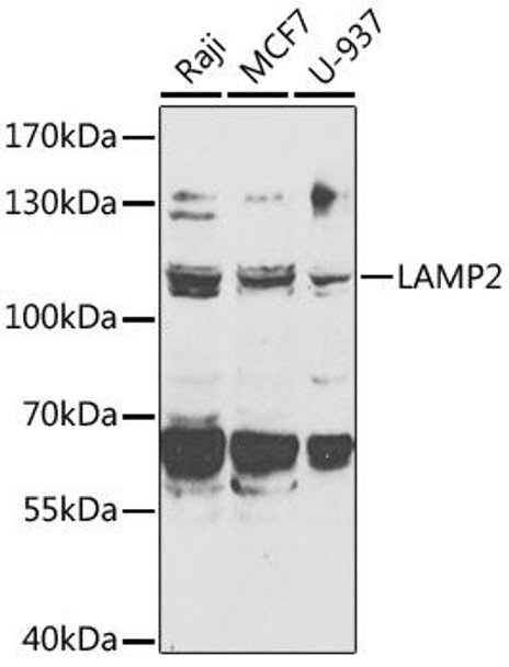 Autophagy Antibodies Anti-LAMP2 Antibody CAB14017