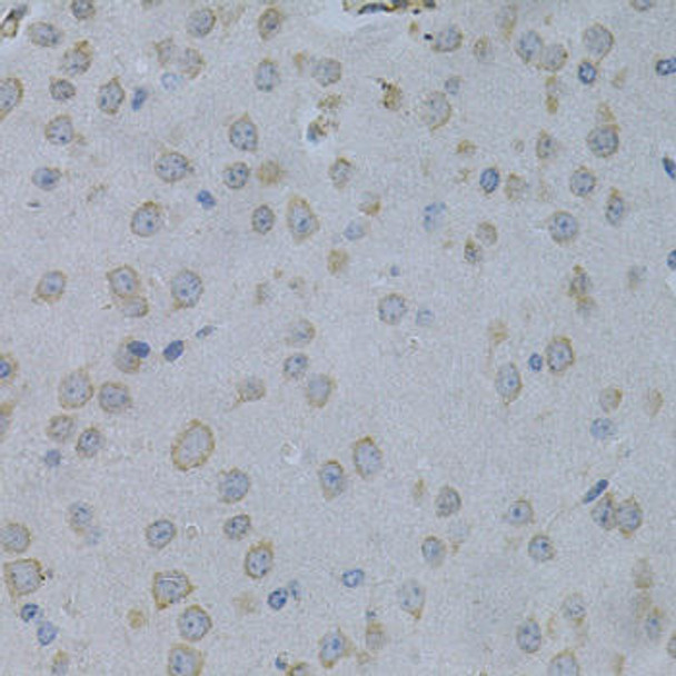 Developmental Biology Anti-STMN1 Antibody CAB14018