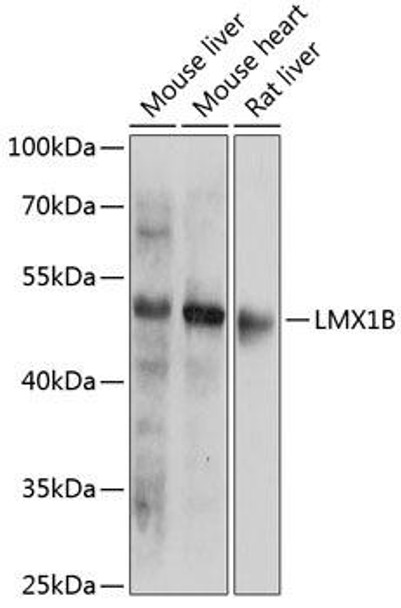 Epigenetics and Nuclear Signaling Antibodies 3 Anti-LMX1B Antibody CAB14020