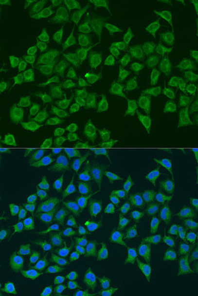 Cell Biology Antibodies 4 Anti-NOS2 Antibody CAB14031