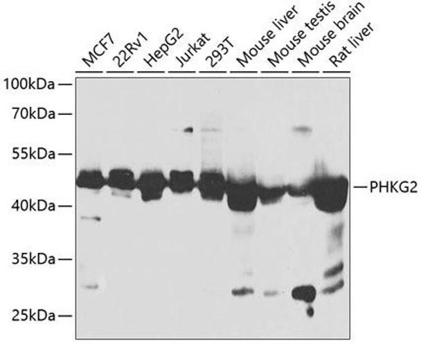 Metabolism Antibodies 1 Anti-PHKG2 Antibody CAB14040